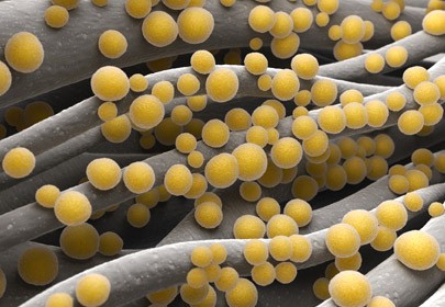 Functional and ultrastructural changes in Pseudomonas aeruginosa and Staphylococcus aureus cells induced by Cinnamomum verum essential oil